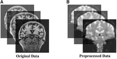 A deep learning framework for identifying Alzheimer's disease using fMRI-based brain network